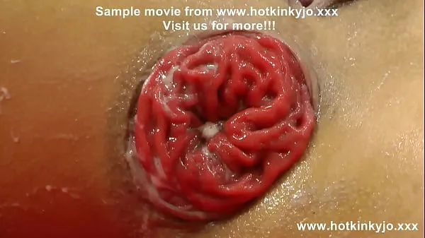 Neue Hotkinkyjo fisting, gape & prolapse 5.12.2022coole Filme